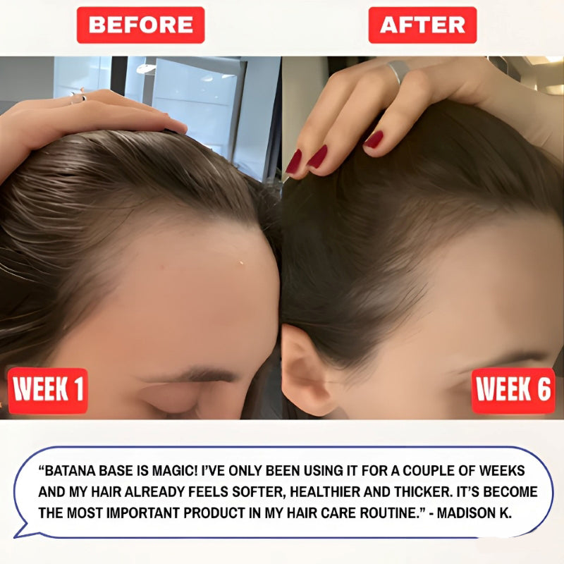 đ„Last Day 50% Offđ„100% Batana Natural Hair Growth Oil