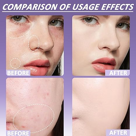 🎁Soft Matte Cream Concealer✨Buy 2 Free Shipping