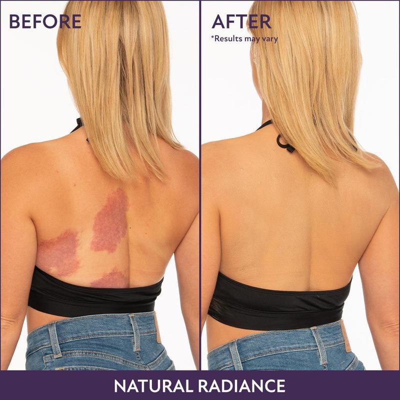 đ«Last Day PromotionâšBeauty Body Coverage Perfector â Waterproof, lightweight & flawless body makeup