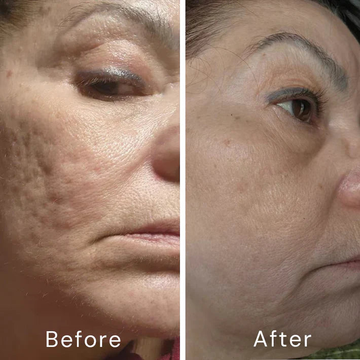 Retinol Skin Cream