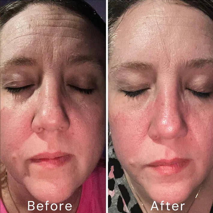 Retinol Skin Cream