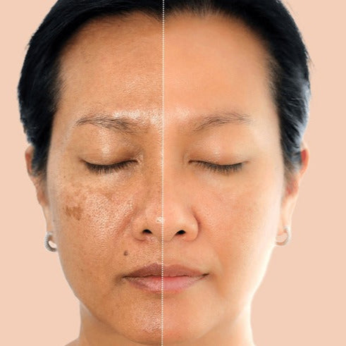Zero Pore Pads 2.0 - 70 Pads