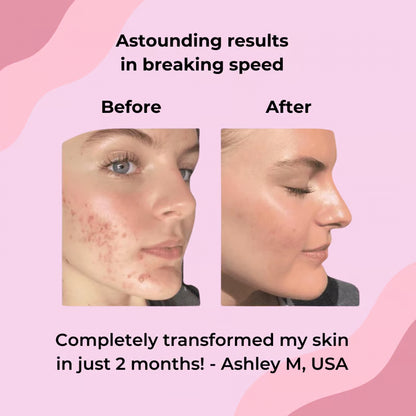 ✨PHOR ESSENTIALS Turmeric And Kojic Acid Exfoliating Pads