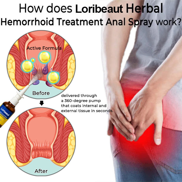 Loribeaut® MAX Herbal Hemorrhoid Treatment Anal Spray