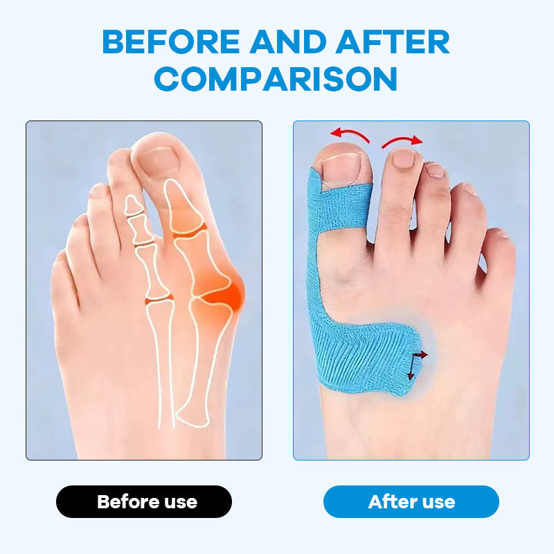 🔥Pre-cut Bunion Corrector Kinesiology Tape