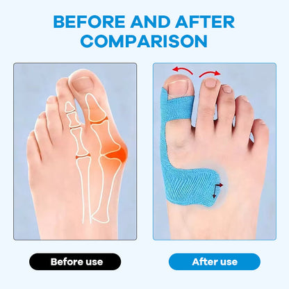 🔥Pre-cut Bunion Corrector Kinesiology Tape