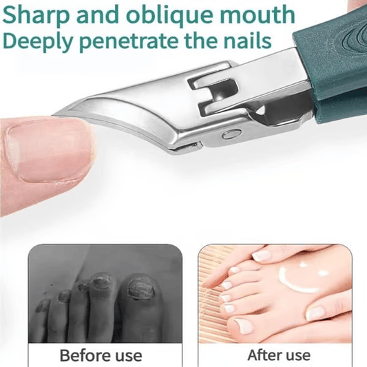 🔥Last Day Sale - Eagle Beak Angled Nail Clippers 3-Piece Set