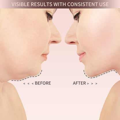 V Line Face Lifting Strap