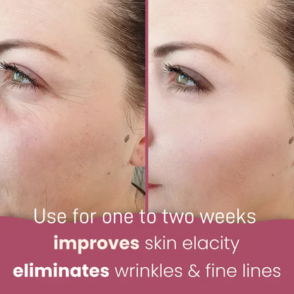 ✨PHOR ESSENTIALS Turmeric And Kojic Acid Exfoliating Pads