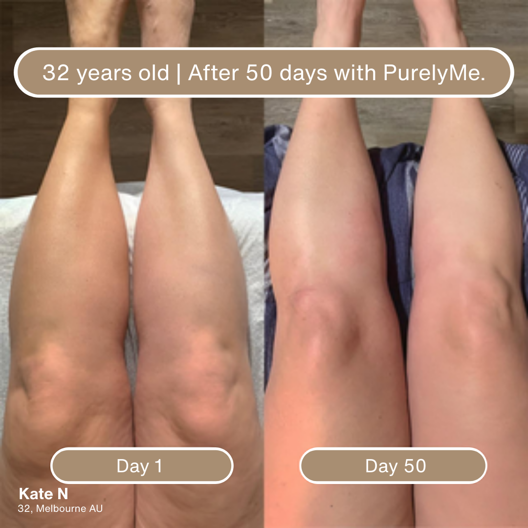 Anti Cellulite Massage Oil