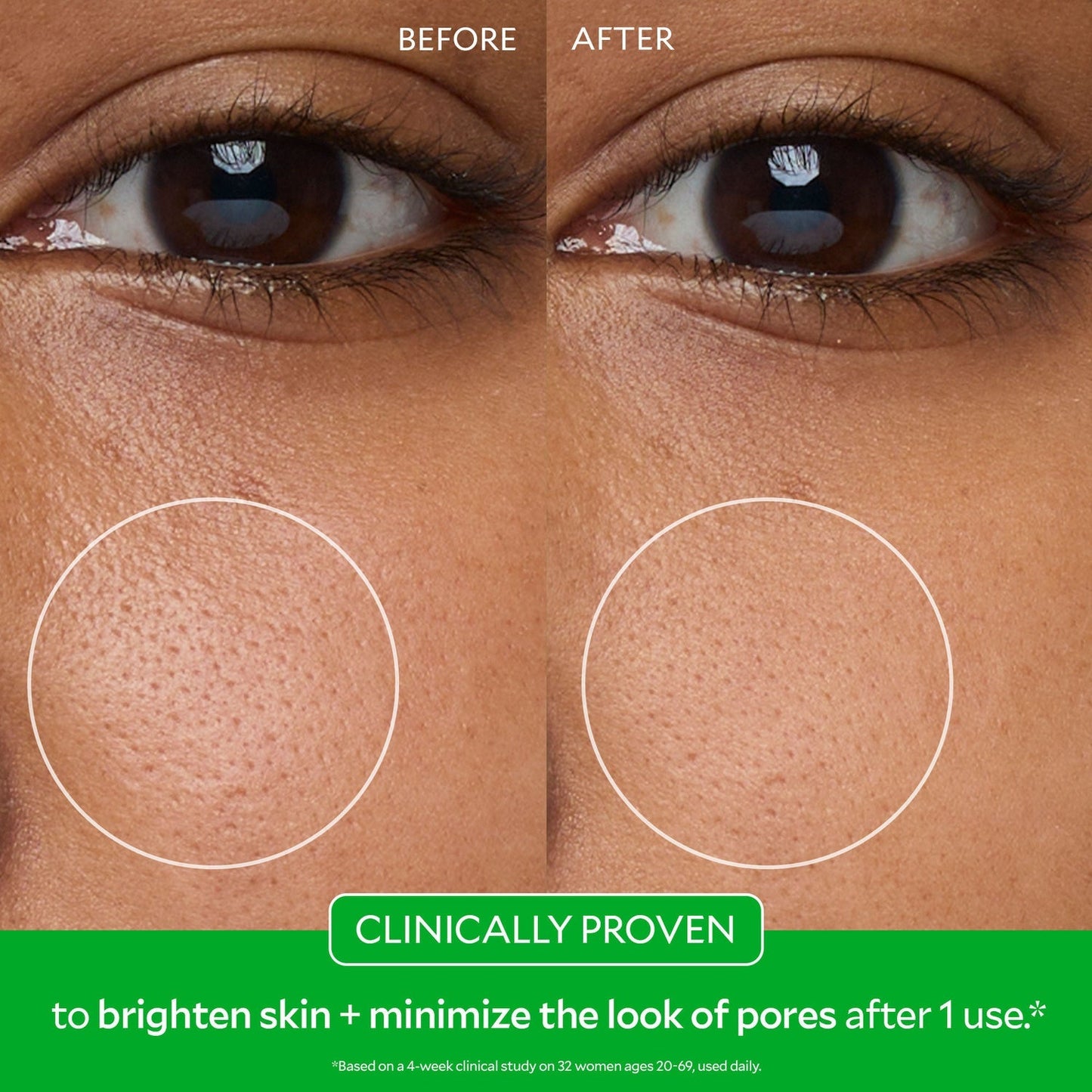 Zero Pore Pads 2.0 - 70 Pads