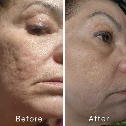 Retinol Skin Cream
