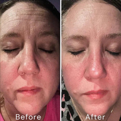 Retinol Skin Cream