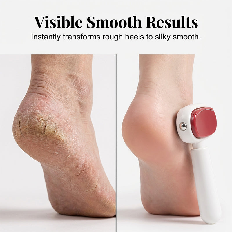 🦶 Double-Sided Foot File – Rough Heel & Dead Skin Remover
